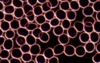 livebloodcell 320x202 1