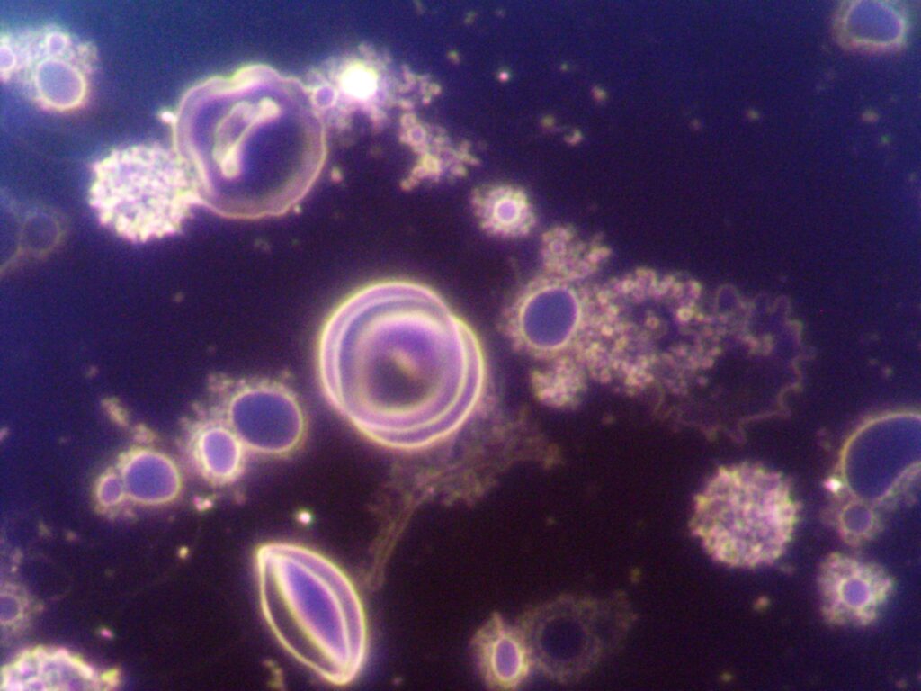 Lyme co infections 2